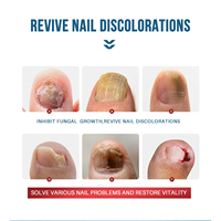 Soin des ongles et des champignons des ongles essence de réparation pour ongles épais cassés décolorés