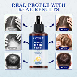 สเปรย์น้ำมันปลูก<span class=keywords><strong>ผม</strong></span>สำหรับผู้หญิงและผู้ชายสเปรย์บำรุงผมร่วงป้องกัน<span class=keywords><strong>ผม</strong></span>ร่วง - Product Image 4