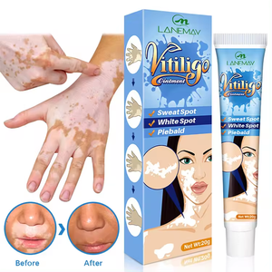 Crème d'extrait de plantes de marque privée pour le psoriasis aux taches blanches pommade localisée pour le <span class=keywords><strong>vitiligo</strong></span> traitement de la mycose leucoplasie - Product Image 2