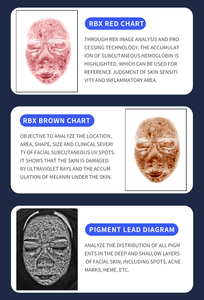 Faible <span class=keywords><strong>tarif</strong></span> 2 Styles de couleur Choisissez Analyseur de test de peau du visage Élasticité Cutomètre X5 Pro Ai Analyseur d'image de peau Machine de beauté - Product Image 4