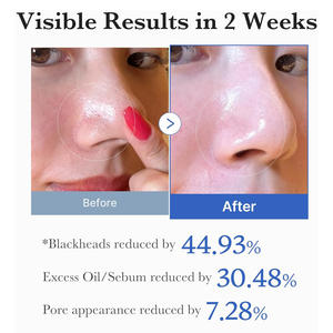 แผ่นโทนเนอร์ดูแลผิวหน้า <span class=keywords><strong>ลด</strong></span>ความมัน <span class=keywords><strong>ลด</strong></span><span class=keywords><strong>สิว</strong></span> กระชับรูขุมขน ด้วย BHA กรดซาลิไซลิก และ AHA กรดแลคติก ช่วยผลัดเซลล์ผิว - Product Image 4