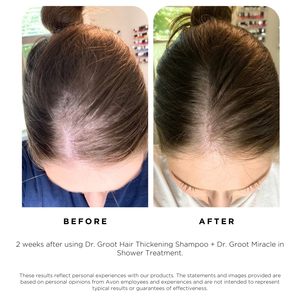 <span class=keywords><strong>Oplus</strong></span> OEM Vente en gros 100% Huile essentielle de romarin biologique à base de plantes naturelles pour le soin du cuir chevelu, sérum pour la croissance des cheveux, étiquette privée - Product Image 4