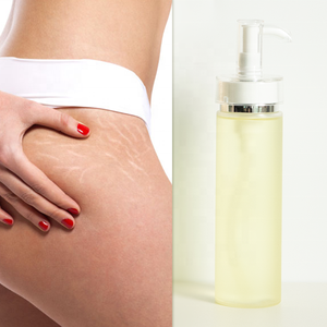 Privated Label Repareren Hydraterende Lotion Voor Anti-Body Striae Verwijdering 150Ml Voor Vrouwen - Product Image 2