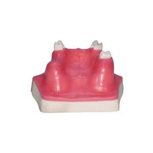 Modèle de communication médecin-patient pour l'implantation dentaire, aide pédagogique orale de classe I pour le lifting du sinus maxillaire, dents manquantes - Product Image 3