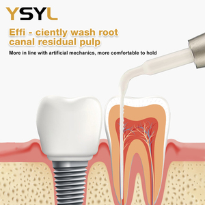 YSYL Efficiënt reinigen van resten van <span class=keywords><strong>pulp</strong></span> in wortelkanaalbehandelingen, hoge temperatuur medische vezelturbine-aangedreven universele orale therapie wortel - Product Image 5