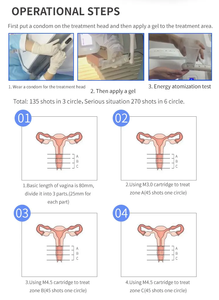 Mejor Máquina Mini <span class=keywords><strong>HIFU</strong></span> Corporal 3.0mm 4.5mm Terapia Focal <span class=keywords><strong>HIFU</strong></span> Ultrasonido Focalizado de Alta Intensidad Cuidado de Reafirmación Vaginal para Salón - Product Image 4