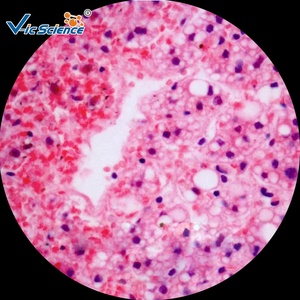 Lames de <span class=keywords><strong>microscope</strong></span> en verre pour hématologie, préparées pour l'analyse sanguine, pour l'enseignement des sciences médicales et la pathologie - Product Image 4