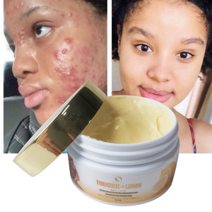 Crème pour le visage au curcuma biologique <span class=keywords><strong>avec</strong></span> <span class=keywords><strong>du</strong></span> rétinol OEM/ODM, crème hydratante blanchissante pour la peau, crème anti-rides et anti-taches - Product Image 3