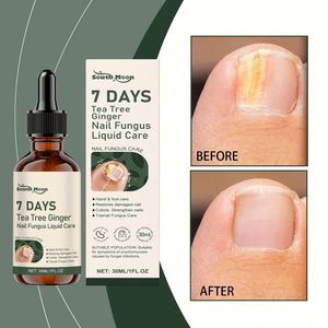 South Moon 30ML Solution Naturelle de Soin des <span class=keywords><strong>Ongles</strong></span> <span class=keywords><strong>à</strong></span> Base de Plantes, Spray Doux Anti-Fongique pour <span class=keywords><strong>Ongles</strong></span>, Infusé <span class=keywords><strong>à</strong></span> l'<span class=keywords><strong>Huile</strong></span> d'<span class=keywords><strong>Arbre</strong></span> <span class=keywords><strong>à</strong></span> <span class=keywords><strong>Thé</strong></span> et au Gingembre - Product Image 2