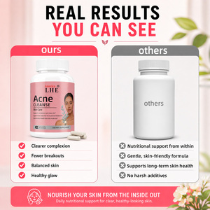 Suplemento Nutracéutico para el Acné, Fabricante de Productos para el Cuidado de la Piel con Vitamina A y Mezcla de Hierbas para una Piel Clara, 90 Cápsulas - Product Image 4