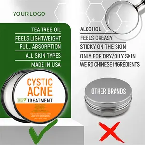 TOP Vegan Cystic Acne Treatment balsamo crema Anti Acne con Aloe Vera Arnica Montana olio dell'albero del tè per eliminare l'acne grave