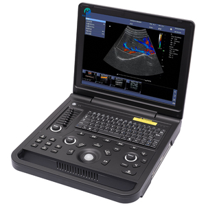 <span class=keywords><strong>Precio</strong></span> del Escáner de Ultrasonido Doppler Color para Aplicaciones en Ecografía Cardíaca, Abdominal y Vascular - Product Image 6