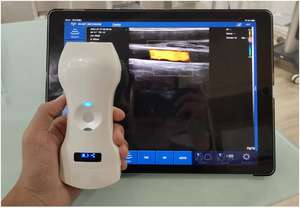 Ecógrafo Portátil <span class=keywords><strong>de</strong></span> 192 Elementos, 3.2-10Mhz, con la Mayor Penetración, Wifi, Doppler Color, Tipo Palm, con 3 Sondas <span class=keywords><strong>de</strong></span> Ultrasonido - Product Image 5