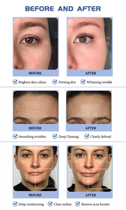 2026 New Technology 14 in <strong>1</strong> Cleaning Face Beauty Facial Machine Skin Peeling Beauty Facial Korea Aqua Peel Machine - Product Image 5