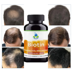 Label pribadi kapsul kolagen <span class=keywords><strong>Biotin</strong></span>, kapsul <span class=keywords><strong>Biotin</strong></span> organik untuk pertumbuhan rambut dan kuku suplemen vitamin <span class=keywords><strong>Biotin</strong></span> - Product Image 3