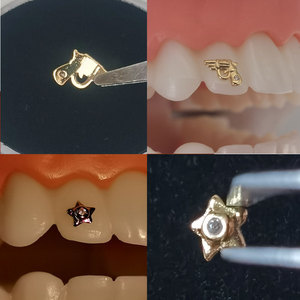 ZZSU - Decoración Dental de Lujo Popular, Gemas Dentales Estilo Hip Hop, Joyería Dental <span class=keywords><strong>para</strong></span> Uso Doméstico, Incluye Muestra Gratis de Joyería Dental - Product Image 5