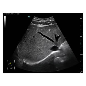 Mingray MX3 peralatan <span class=keywords><strong>Ultrasound</strong></span>, alat diagnostik portabel untuk penggunaan dokter hewan - Product Image 5