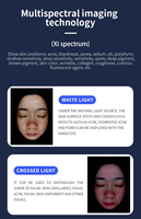 Scanner facial 3D AI Analyseur de peau Analyseur de cuir chevelu Salon Usage domestique Haute définition Test d'humidité spectrale Diagnostic sans fil