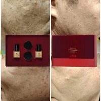 Ensemble de soins de la peau blanchissants de marque privée OEM pour le traitement de l'hyperpigmentation des taches brunes ensemble de soins de la peau à la vitamine C anti-taches brunes