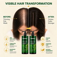 Shampooing pour la croissance des cheveux, ensemble de produits de soin capillaire de luxe, sans sulfate, végétalien, huile de romarin, biotine, masque et après-shampoing à la kératine