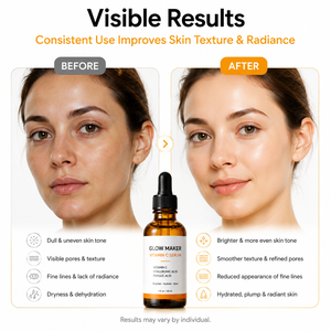 Suero Facial Personalizado con Vitamina C, Iluminador, Antienvejecimiento, Hidratante y con Vitamina E, Ácido Ferúlico y Ácido Hialurónico, 30 ml - Product Image 3