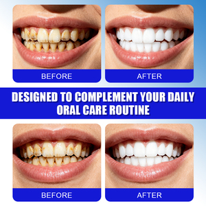 <span class=keywords><strong>Dentifrice</strong></span> naturel aux herbes, niacinamide, blanchissant, élimine la mauvaise haleine, saveur menthe, <span class=keywords><strong>dentifrice</strong></span> blanchissant - Product Image 3