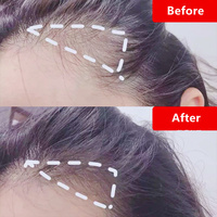 Sérum multi-peptides ZS OEM pour la densité des cheveux, formule à base de peptides pour des cheveux plus épais et plus volumineux, sérum de repousse des cheveux aux peptides