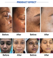 Ensemble Éclaircissant Naturel pour le Visage Produits de Soin Kits Étiquette Privée Vente en Gros Kit de Blanchiment Éclaircissant pour la Peau au Glutathion