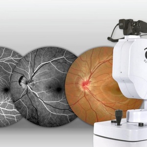 Caméra de fond d'œil automatique YDC09 à bas prix, caméra FFA / caméra de rétine, photographie de fond d'œil non mydriatique pour l'ophtalmologie - Product Image 2