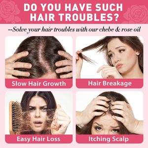 OEM Custom Herbs Herbal Natural Biotin Nourishing Regrowth <strong>Oils</strong> Rapid Rosemary <strong>Oil</strong> for Hair Growth Products Private Label - Product Image 3