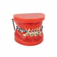Modèle d'orthodontie dentaire Fultone, modèle complet avec bracket métallique, fil d'arc, modèle d'étude dentaire standard