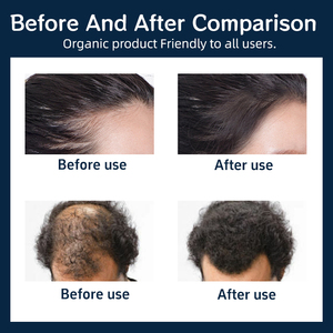 Siero per la crescita delle sopracciglia da 50 ml, ingredienti liquidi organici, trattamento impermeabile, previene la caduta dei capelli, stimola la crescita dei capelli per uomini e donne - Product Image 4