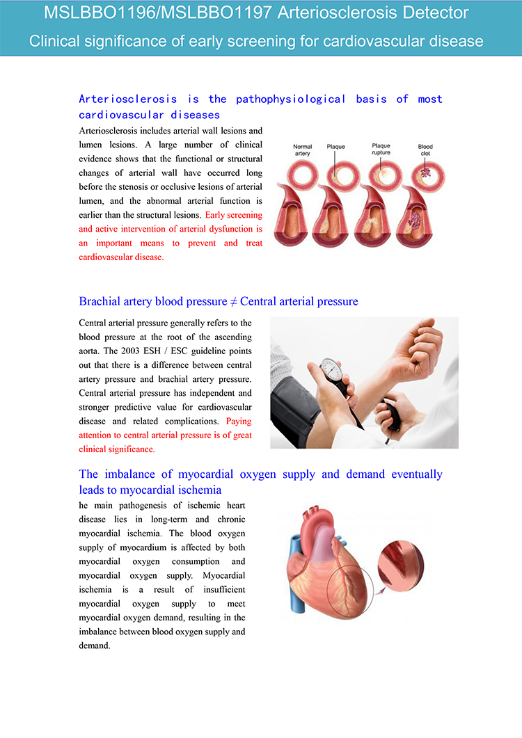 Importancia clínica del cribado temprano de la enfermedad cardiovascular Detector de arteriosclerosis de alta configuración