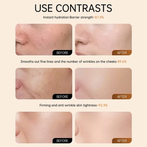 Riparazione con Olivello Spinoso e Glicerina per OEM ODM |   Siero <span class=keywords><strong>Viso</strong></span> Idratante Anti-Età 40ml con Stampa in Oro per Pelli Sensibili - Product Image 2