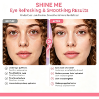 Patch oculaire au rétinol ODM OEM, gel anti-rides, masque pour les yeux PDRN, masque hydrogel pour les yeux au DNA de saumon
