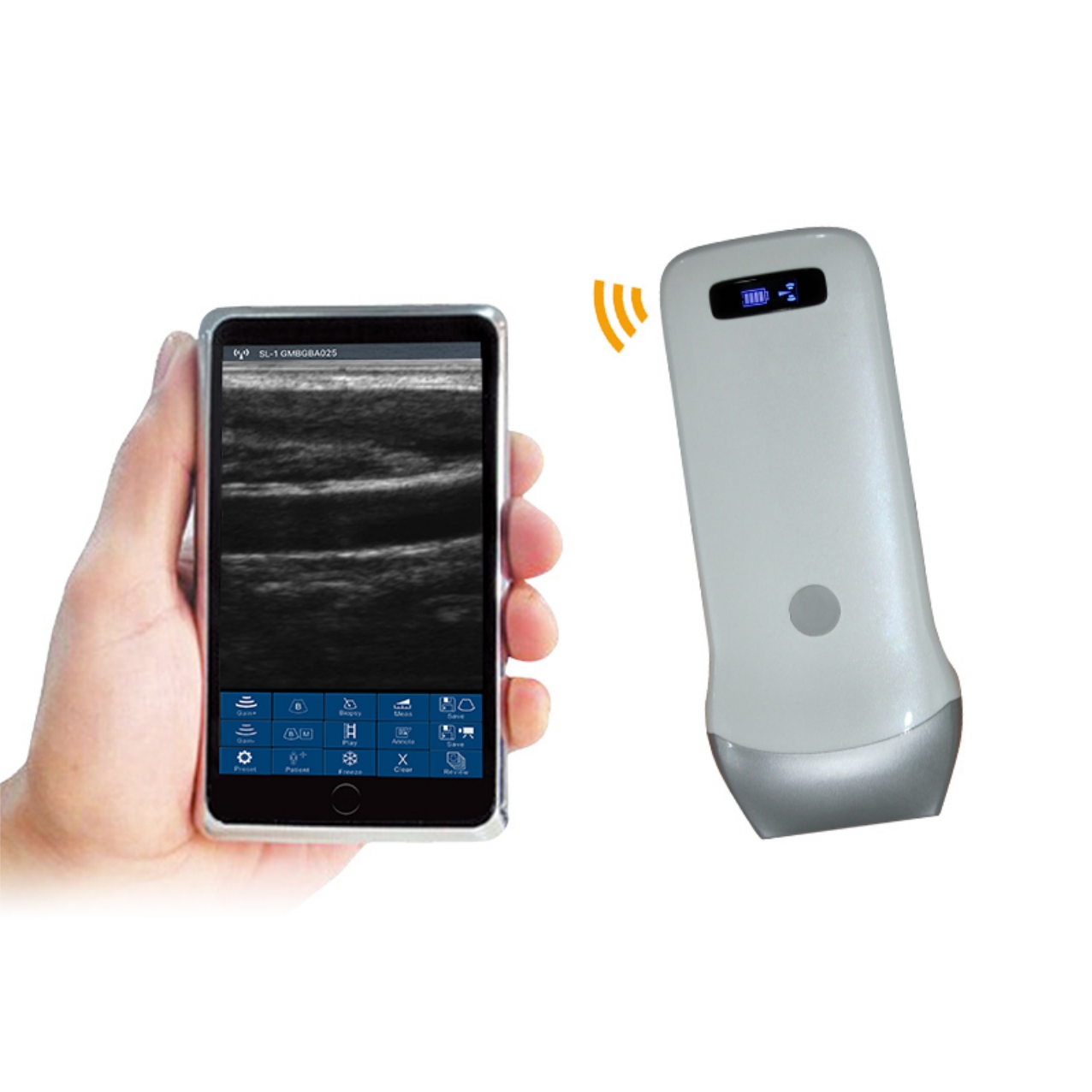 Wireless Convex Probe Wireless Convex Probe