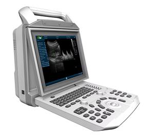 Amain harga pabrik <span class=keywords><strong>B</strong></span> & <span class=keywords><strong>W</strong></span> <span class=keywords><strong>Ultrasound</strong></span> portabel hitam dan putih <span class=keywords><strong>Ultrasound</strong></span> AMPU46 - Product Image 3