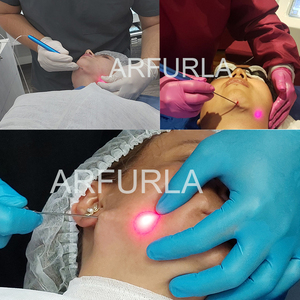 Endoláser 2026 de Última Generación 980nm 1470nm para Lifting Facial y Lipólisis, Eliminador de Grasa - Product Image 3