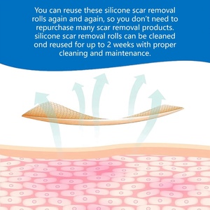 Silicone Sẹo Tấm Tái Sử Dụng Silicone Sẹo Băng Cho C-Phần Keloid Vết sưng <span class=keywords><strong>Stretch</strong></span> <span class=keywords><strong>Marks</strong></span> Burn Tummy Tuck Phẫu Thuật Loại Bỏ Vết Sẹo - Product Image 4