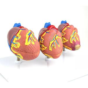 Modèle <span class=keywords><strong>de</strong></span> comparaison du cœur humain sain <span class=keywords><strong>et</strong></span> malade en 3 pièces, modèle d'enseignement <span class=keywords><strong>de</strong></span> l'anatomie des lésions cardiaques pour l'éducation en classe <span class=keywords><strong>de</strong></span> biologie - Product Image 4