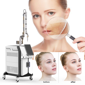 เลเซอร์กำจัดจุดสำหรับลบรอยสักเพื่อทำให้ผิวขาวขึ้น - Product Image 2