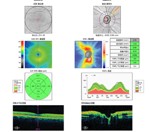 OCT-500 optikal kail Tomographie, peralatan diagnostik pencitraan <span class=keywords><strong>Retinal</strong></span> pemindaian optik Oktober - Product Image 3