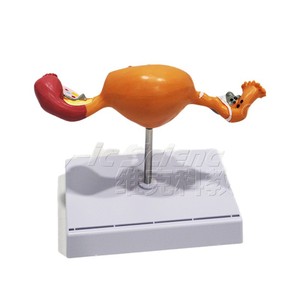 Modelo patológico uterino femenino, modelo anatómico de órgano reproductor ginecológico, molde para enseñanza y formación médica. - Product Image 5