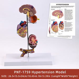 Modelo Anatómico <span class=keywords><strong>de</strong></span> 5 Partes <span class=keywords><strong>de</strong></span> los Órganos del Cerebro, Corazón, Ojo, Riñón y Vasos Sanguíneos, Producto <span class=keywords><strong>de</strong></span> Ciencia Médica para <span class=keywords><strong>el</strong></span> Estudio <span class=keywords><strong>de</strong></span> la Hipertensión - Product Image 1