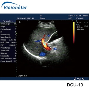 China DCU-10 Color Doppler Portable Veterinary Animal <strong>Ultrasound</strong> <strong>Machine</strong> <strong>for</strong> <strong>Sale</strong> - Product Image 5