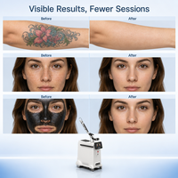 Machine à peeling au laser au carbone, équipement de beauté pour salon et clinique, élimination des pigments, élimination des tatouages, rajeunissement de la peau, laser Pico