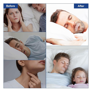 Parche Nasal Antirronquidos de Alta Calidad con Ventilación, Promueve la Respiración Nasal, Hipoalergénico, Cinta Bucal, Embalaje Personalizado - Product Image 4