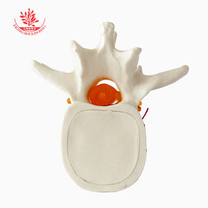 FRT039, un modelo ampliado de la columna lumbar, se utiliza para la enseñanza y demostración de la hernia de disco lumbar. - Product Image 3