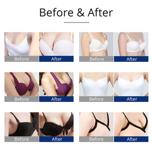 BBL Vacuum Breast Machine Therapy Cupping <strong>Bra</strong> Enhancement With 24 Cups - Product Image 4