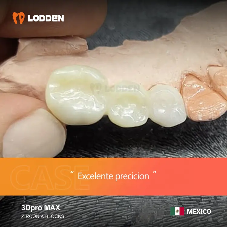 Fournitures dentaires Matériaux Circonio 3D Pro Max Multicouche Zircone 100% Sinocera Natural Transitions Para Laboratorio Dental